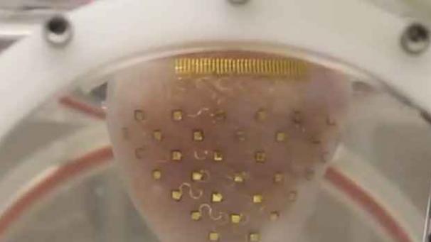 Edition numérique des abonnés