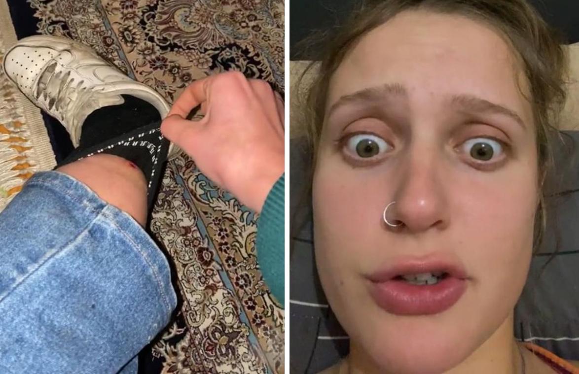 Vrouw voelt iets bewegen in haar kous en schreeuwt het uit als ze ziet wat het is (video)