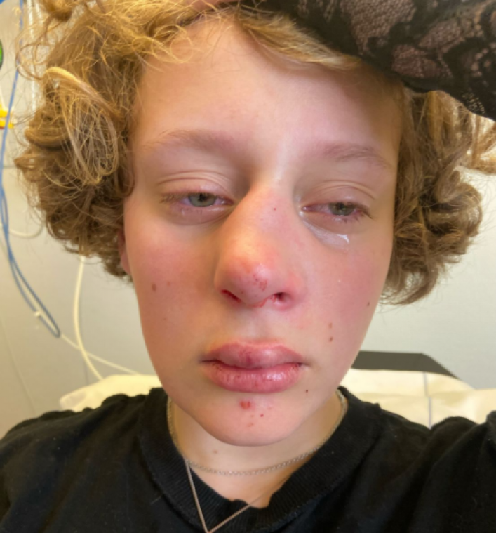 Nederlands meisje aangevallen omwille van androgyn uiterlijk: «Neus, tanden en kaak gebroken»