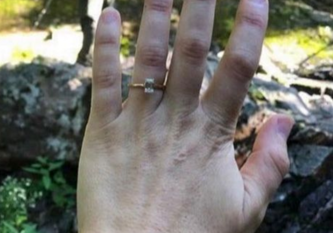 Vrouw pronkt met foto van verlovingsring, maar gênant ‘detail’ op de achtergrond steelt de aandacht … (foto)