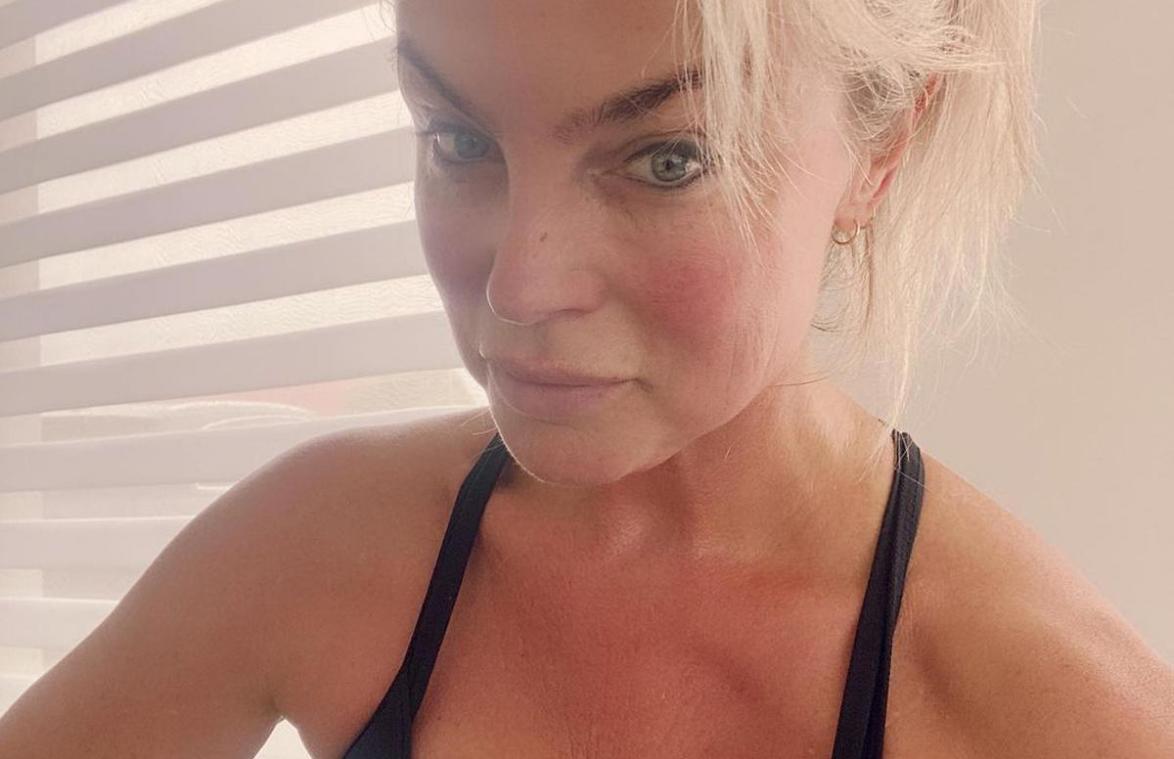 Joyce De Troch laat haar cellulitis verwijderen: «Zo gelukkig met het resultaat!» (foto’s)