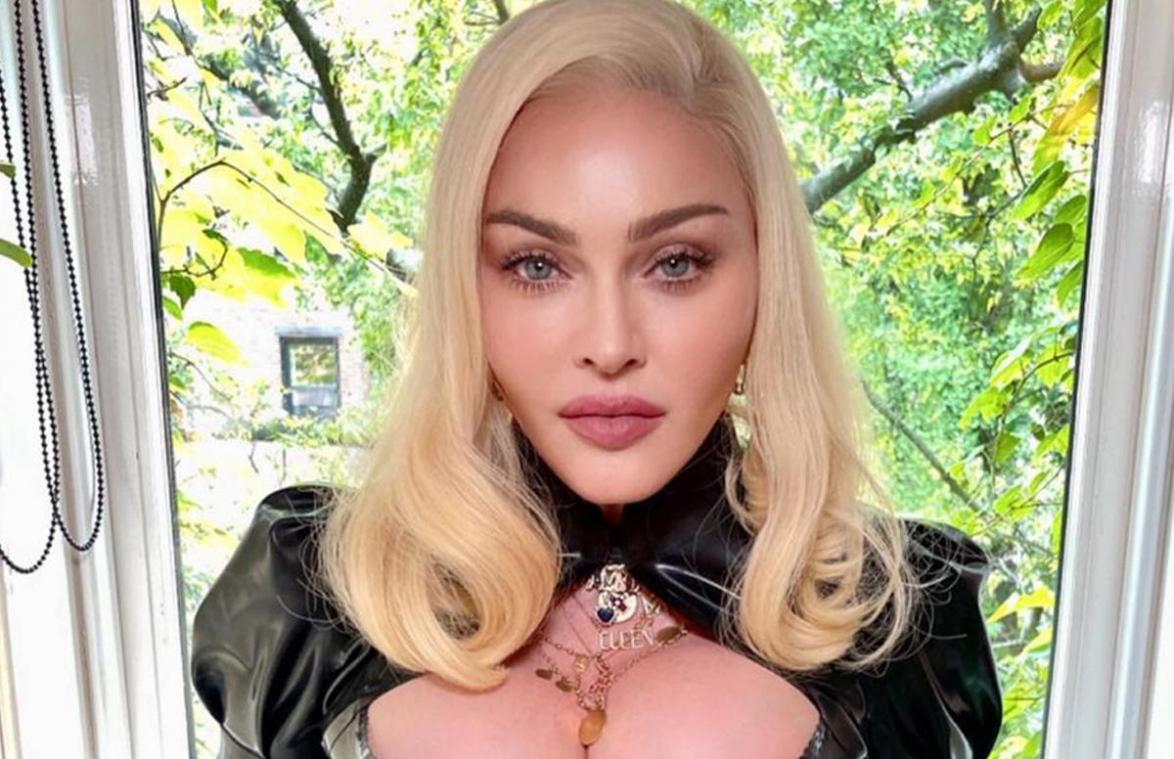 Fans van Madonna maken zich zorgen: «Mijn God, wat heb je jezelf aangedaan?» (foto)