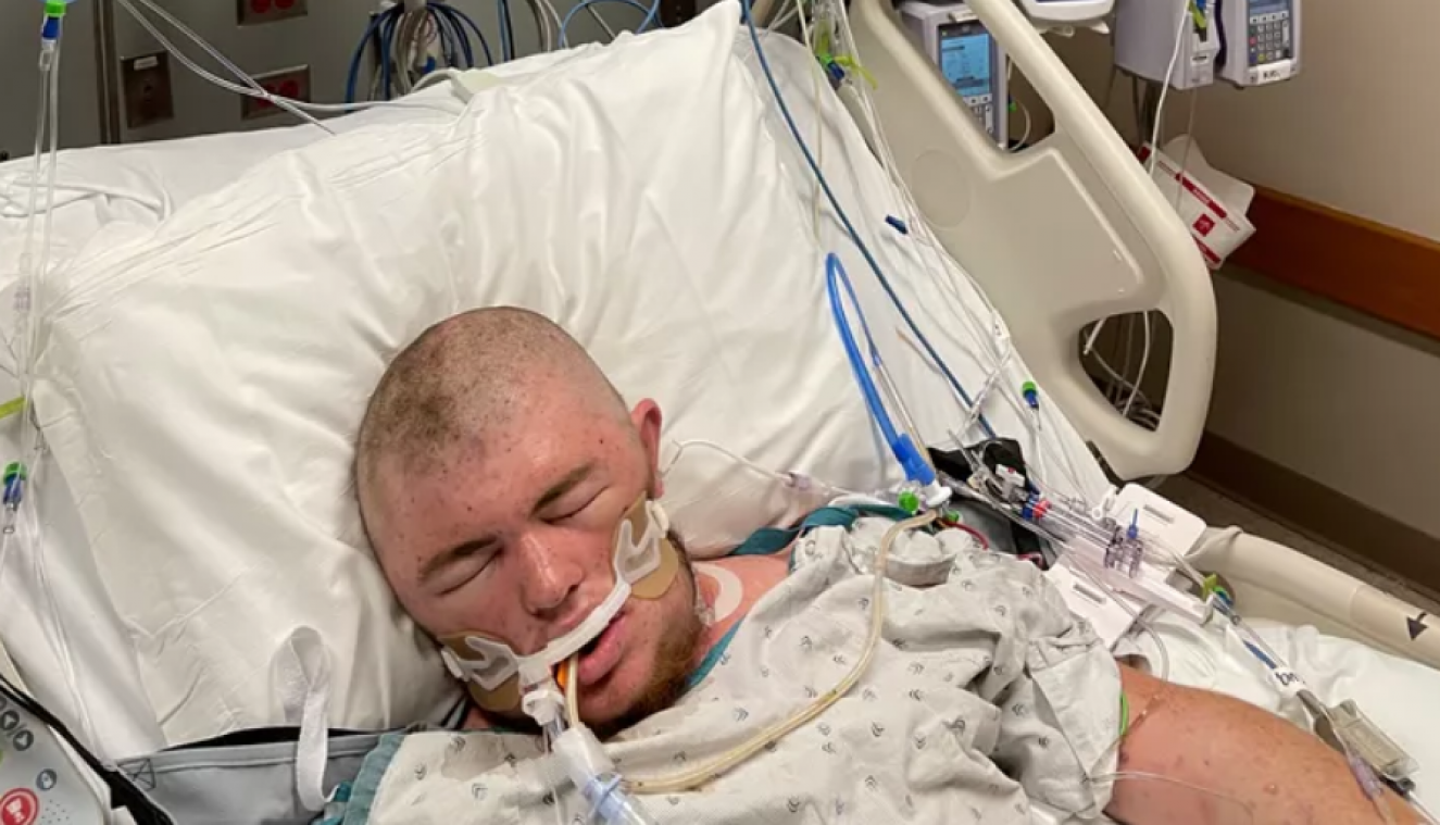 WOW. Man ontwaakt uit coma nadat hij 20.000 keer gestoken werd door ‘killer bees’ (foto’s)