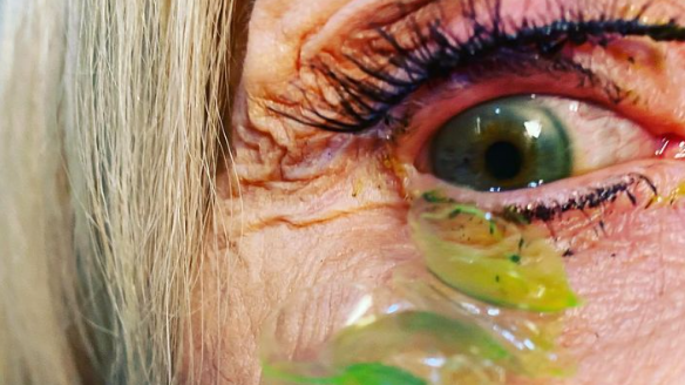 IEUW. Deze vrouw zal nooit nog met haar lenzen in gaan slapen (video)