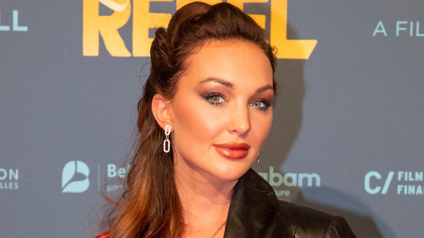 Miss België Chayenne Van Aarle toont verwondingen na horrorcrash: «Bedankt voor alle liefde» (foto)