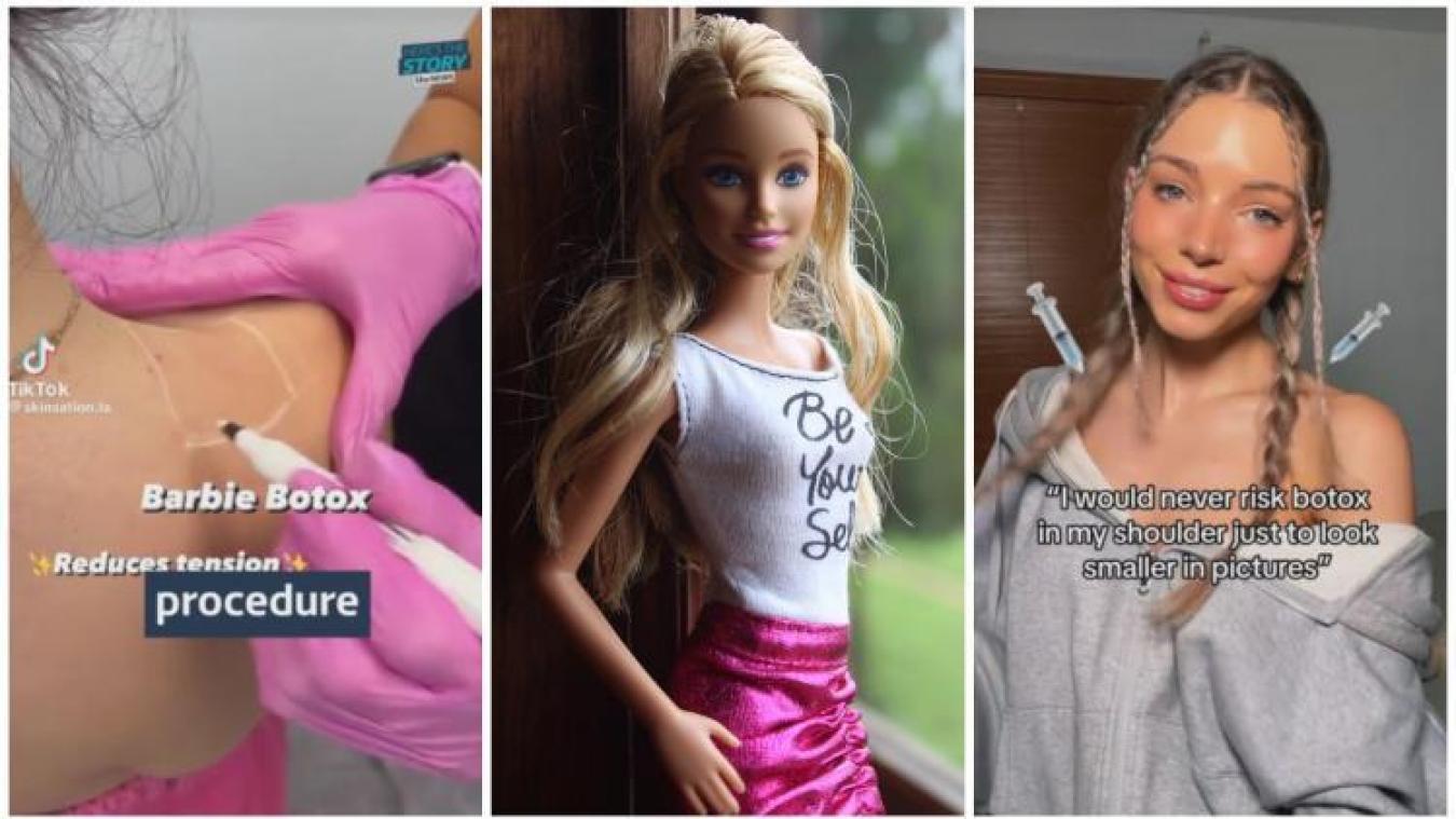 Barbie Botox: experts waarschuwen voor nieuwe beautytrend (video)