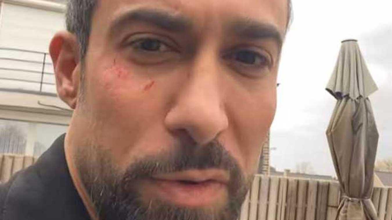 Fabrizio Tzinaridis loopt verwondingen op door storm Ciarán: «Wees extra voorzichtig!» (foto)