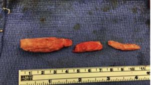 content-1642589851-foam2